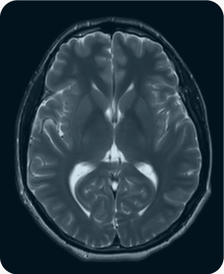 BRAINMRI