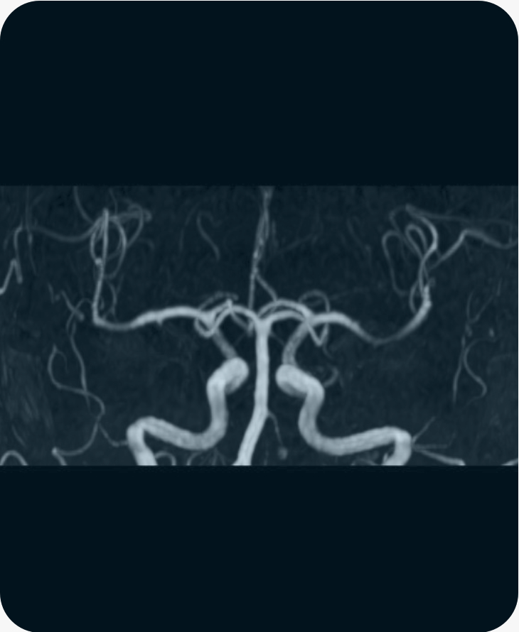 COWMRI