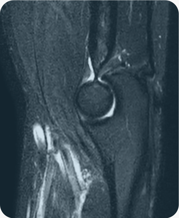 MSKMRI